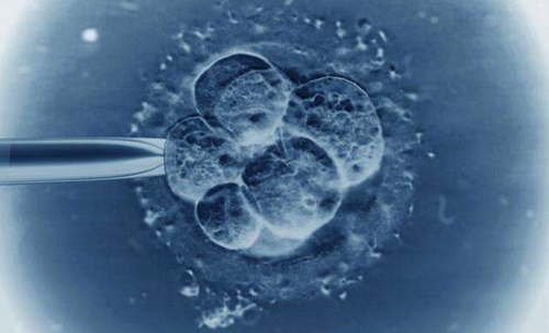 泰国试管胚胎移植的条件有哪些？
