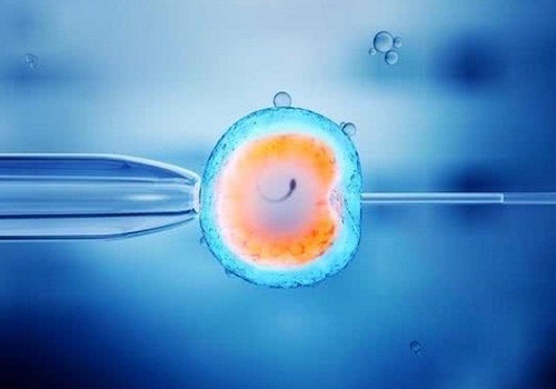 精子碎片率高是什么原因？能做三代试管婴儿吗？