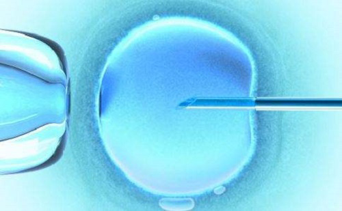 精子异常导致胚胎碎片率高怎么办？