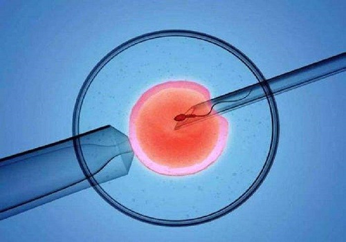 精子碎片率高能做三代试管吗？如何解决？